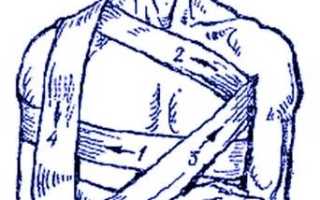Использование повязки Дезо при травмах плеча и ключицы