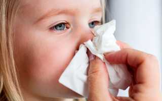 Что делать при носовом кровотечении у ребенка