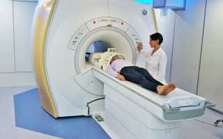 Этапы подготовки к МРТ головного мозга