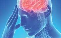 Последствия и осложнения после сотрясения головного мозга